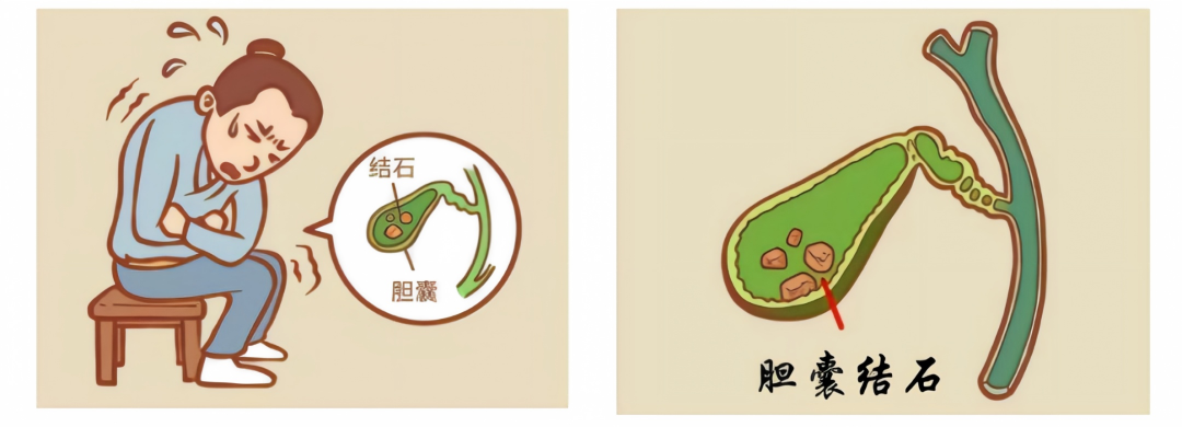 岳阳济和医院,岳阳结石专科,岳阳泌尿结石专科,岳阳精准碎石,治疗结石哪家医院好